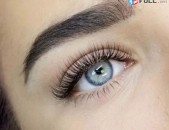 Tratichneri ev honqeri  laminacia nerkum BOtox uscum